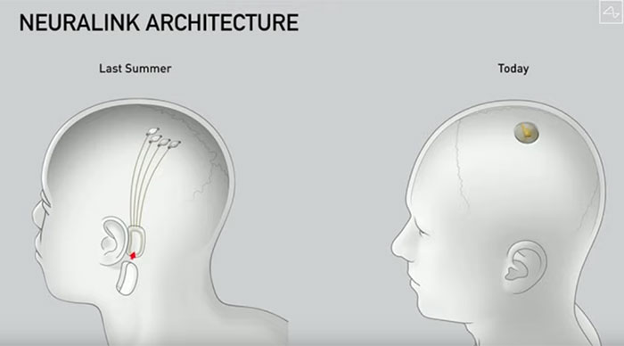 Elon Musk demos Neuralink Brain Computer Interface update - General